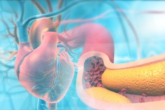 Human heart with clogged arteries.3d illustration..